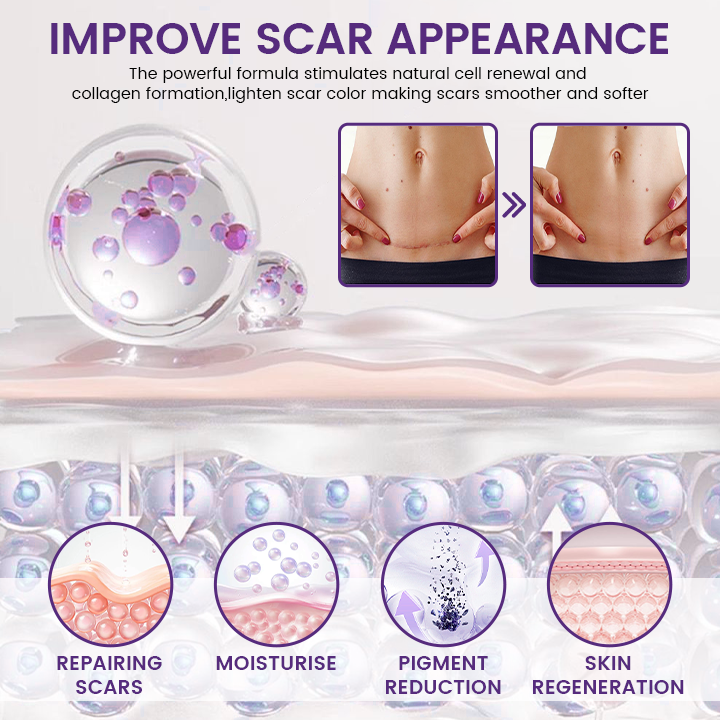 Timilk Regenscar Scar Gel 20g β Triple Action Gel for Old & New Scars